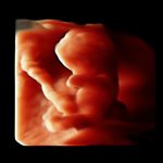 USG wczesna ciąża